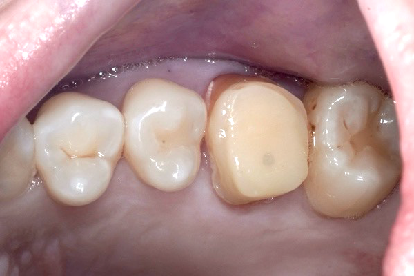 口腔内写真・顔貌写真の撮影