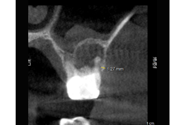 口腔内写真・顔貌写真の撮影