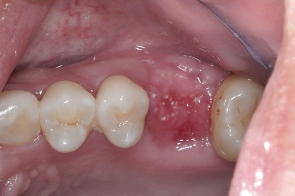 口腔内写真・顔貌写真の撮影