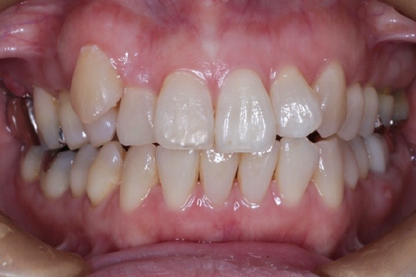 口腔内写真・顔貌写真の撮影