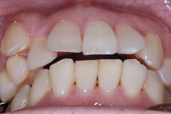 口腔内写真・顔貌写真の撮影