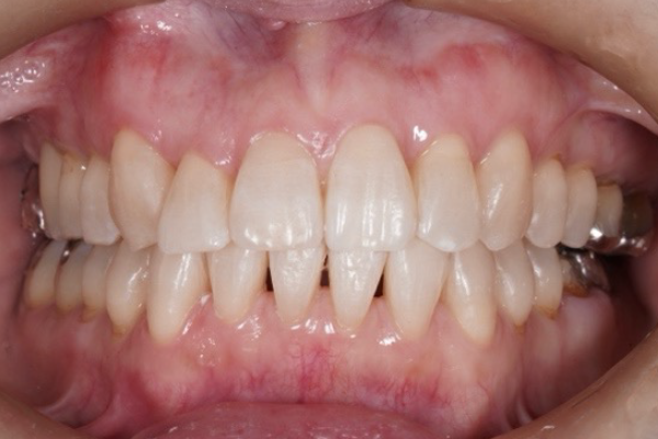 口腔内写真・顔貌写真の撮影