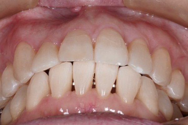 口腔内写真・顔貌写真の撮影