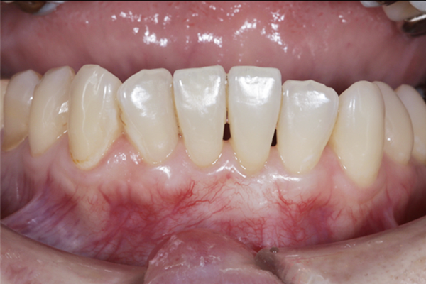 歯周病 荒川デンタルクリニック